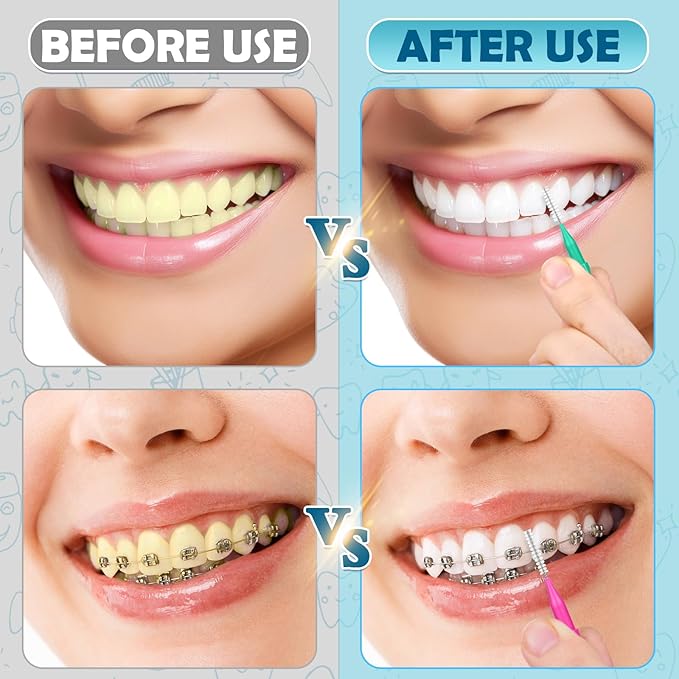 120 Pieces Interdental Brushes Between Teeth, Braces Toothbrush Flossers Cleaner Dental Floss Picks for Teeth Braces Orthodontic Hygiene Cleaning Tools (Bright Colors, Multiple Sizes)