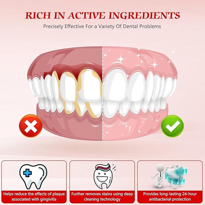 SP-6 Probiotic Whitening Fluoride Free Toothpaste, Upgraded Formula | Ultra Brightening | Gums & Enamel Repair | Mint Flavor | Dental Fresh | Removes Stain & Plaque | Sensitive Teeth Protection