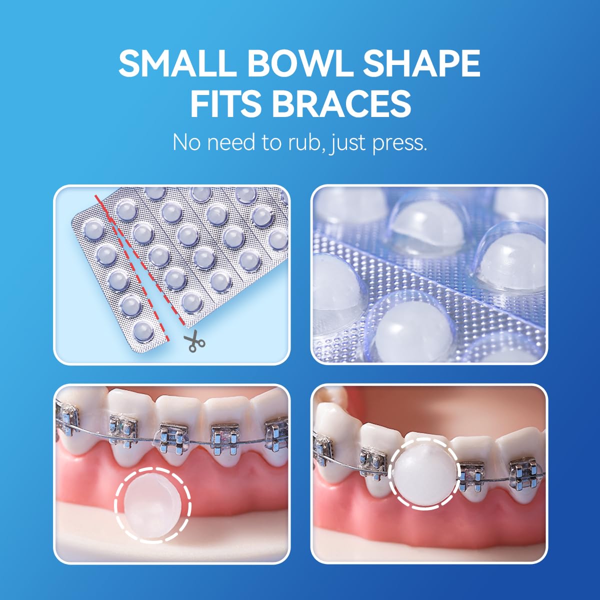 YANDY Orthodontic Wax for Braces,New Upqraded Bowl-Shape,Dental Wax,Pain Relief for Braces,90 Individually Packed, No Kneading Needed,Original Flavor,Braces Kit.