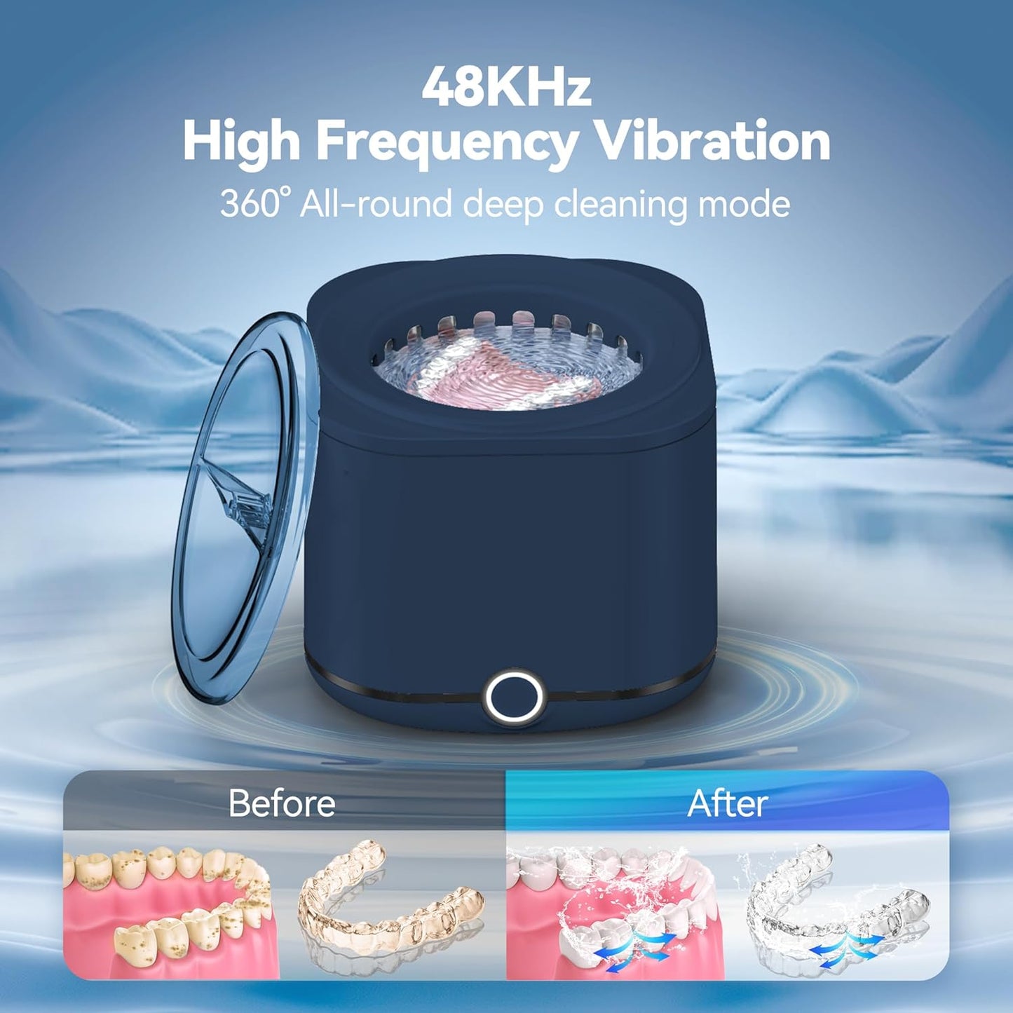 Retainer Cleaner, 48kHz Ultrasonic Retainer Cleaner Machine for Denture, Mouthguard, Braces, Night Guard, Aligner, Toothbrush, Jewelry with 7.8OZ Dental Cleaning Pod-Blue