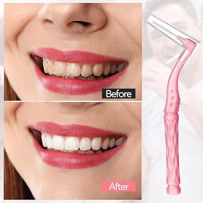 100pcs Interdental Brushes, 5 Sizes Braces Brush Set Soft Dental Brushes with Non-Slip Handle Angled Head Tooth Picks Floss Sticks Dental Floss Brushes for Braces Oral Cleaning