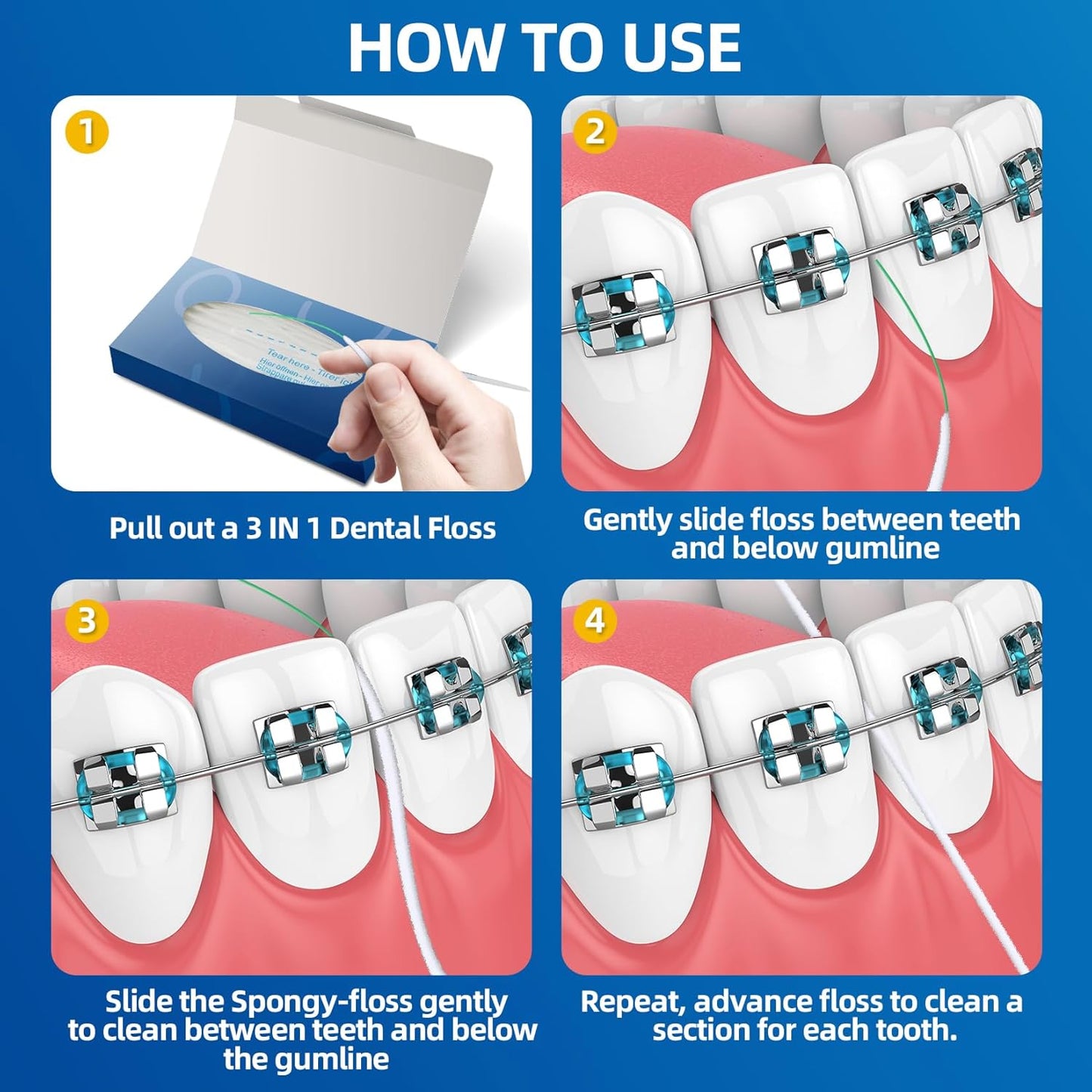 Bopika Dental Floss for Braces, 3 in 1 Ultimate Floss, Floss Threaders for Bridges and Implants, 80 Pre-Cut Strands (Pack of 3)