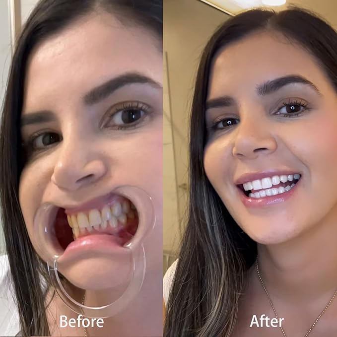 Instant Teeth Whitening Booster, Purple Toothpaste for Teeth Whitening, Purple Toothpaste, Tooth Stain Removal Colour Corrector Serum – Non-Invasive Treatment for Yellow Stains