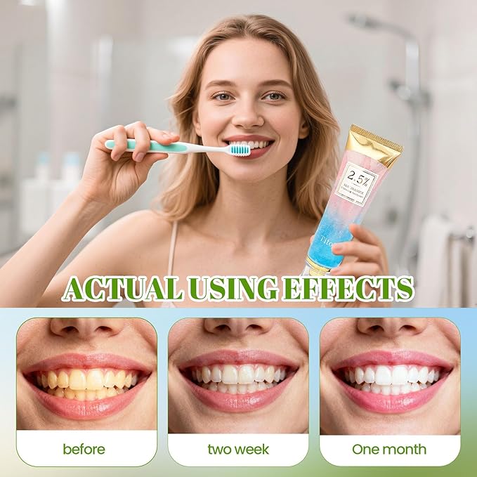 Niacinamide Whitening Toothpaste, 2.5% Niacinamide Intensive Whitening Toothpaste with Natural Gentle Care Deep Stain Removal Clean Mint Flavor, Improves Gum Health, Fresh Breath (1)