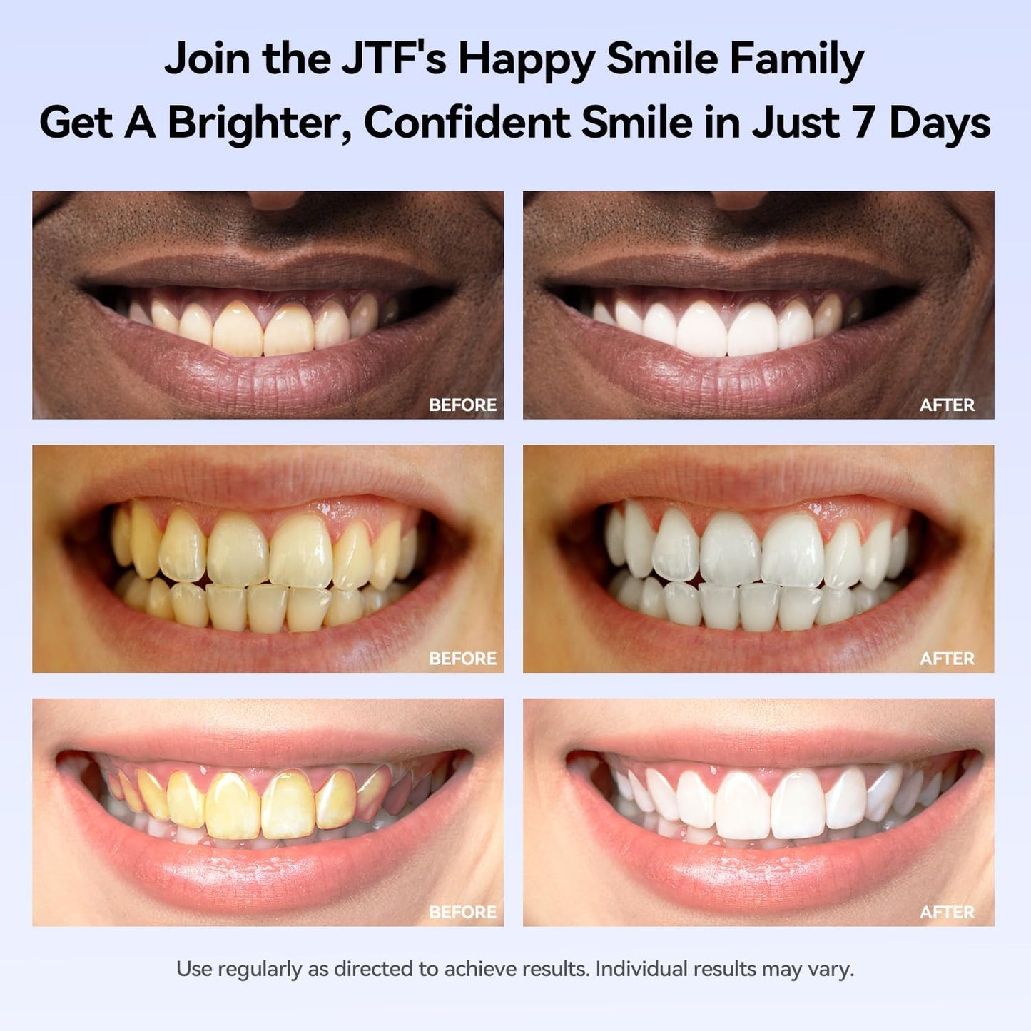 JTF Teeth Whitening Gel Kit: 35% Carbamide Peroxide, 5Pcs Teeth Whitener Gels and 1 Remineralization Gel to Remove Stains from Coffee Food and Smoking, Enamel Safe and No Sensitivity, Mint