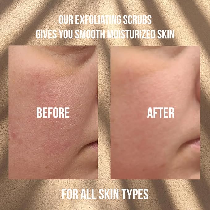 Arabica Coffee Scrub, Moisturizing Exfoliating Face, Body Foot, Hand, Natural Exfoliating for Smooth Skin, Organic Scrub Fights Stretch Marks, Appearance Cellulite, Fine Lines & Wrinkles