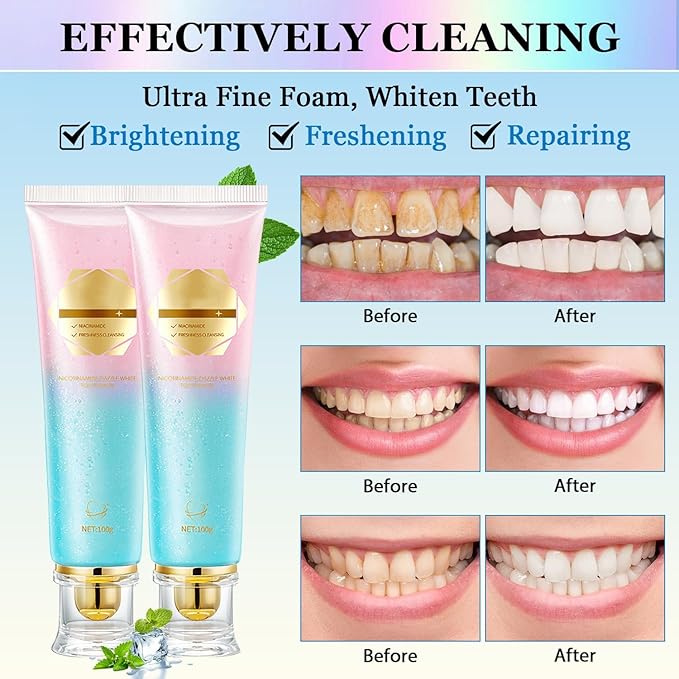 Niacinamide Whitening Toothpaste Acssart Radiant White Toothpaste,Niacinamide Intensive Whitening Toothpastes,Nicotinamide Radiant Whiten Toothpastes (1)