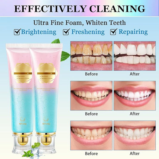 Niacinamide Whitening Toothpaste Acssart Radiant White Toothpaste,Niacinamide Intensive Whitening Toothpastes,Nicotinamide Radiant Whiten Toothpastes (3)