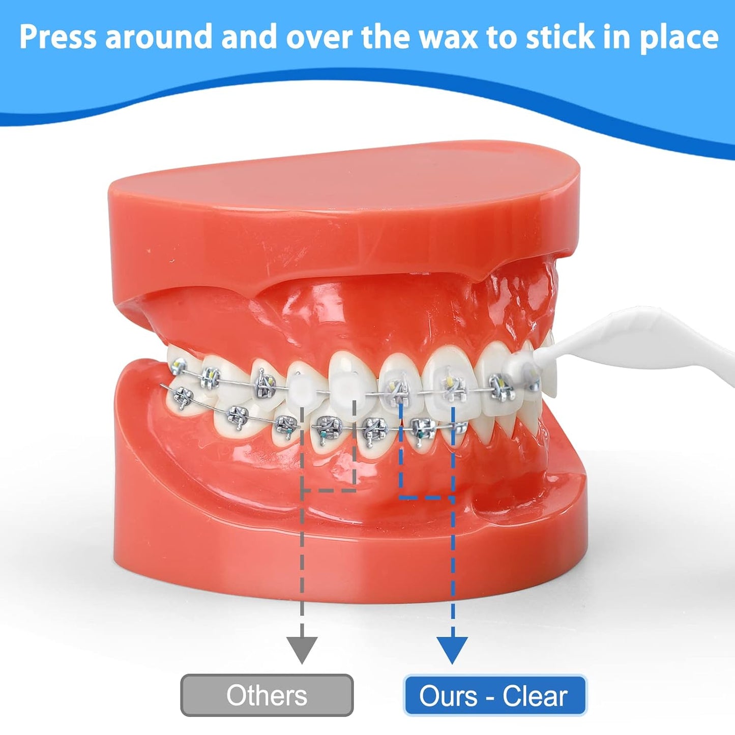 Braces Wax, Premium 50 Precut Orthodontic Wax Strips 350+ Dots, Blue Cases, w/Storage Box & 2 Applicator Tools, Food-Grade Dental Wax for Braces - Stick Better (Mint+Aloe Vera +Vitamin E)