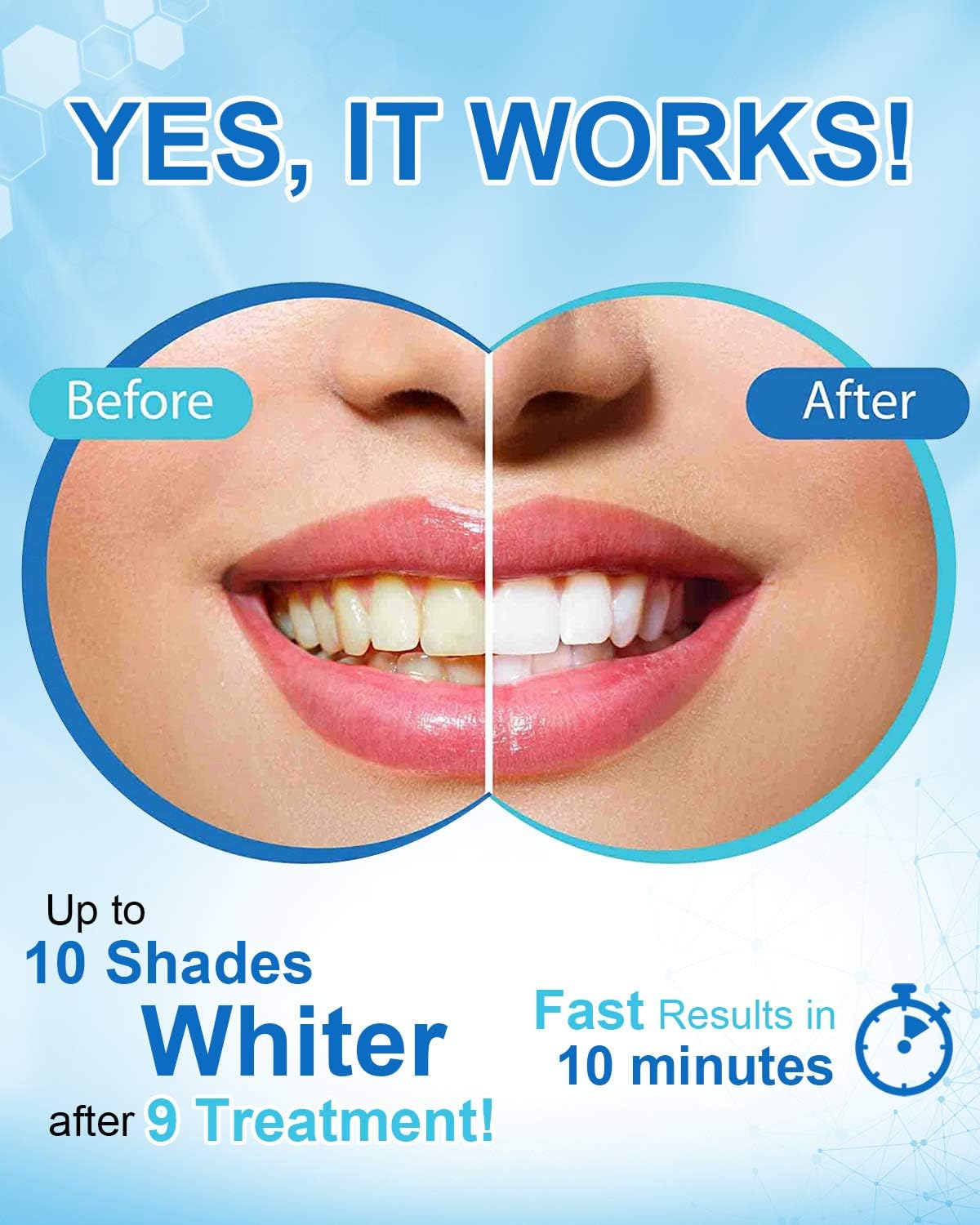 MySmile Non-Sensitive Teeth Whitening Pen Mint Gel Enamel Safety 8ML 30+ Treatments Fast Remove 20 Years of Stains Care Oral Bright Smile Alternative Teeth Whitening Strips ﻿