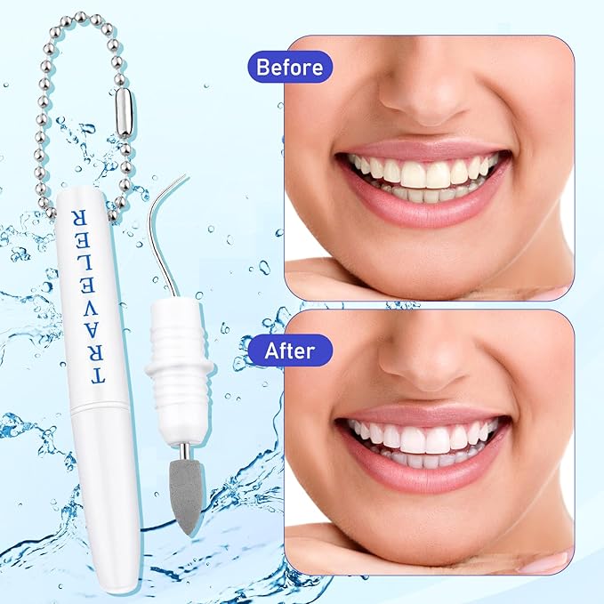 2PCS Premium Metal Toothpick Kit,Professional Teeth Cleaning Tools with Tartar&Plaque Remover,Portable Dental Picks Travel Tools,Reusable Oral Hygiene Tools with Keychain
