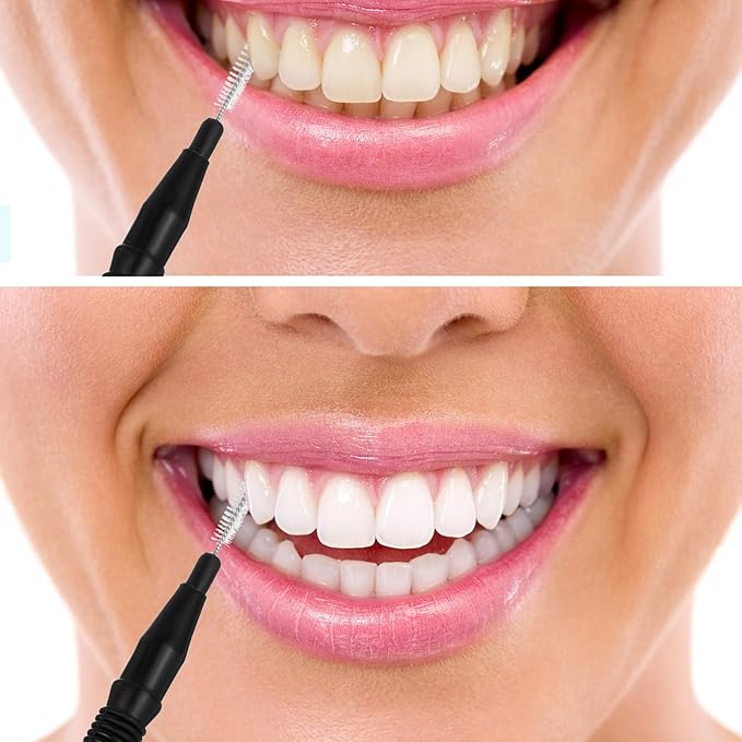BBTO 100 Pcs Braces Dental Brush Flosser for Cleaner Interdental Brush Toothpick Tooth Flossing Head Oral Dental Toothpick Cleaners Cleaning Tool(Black)