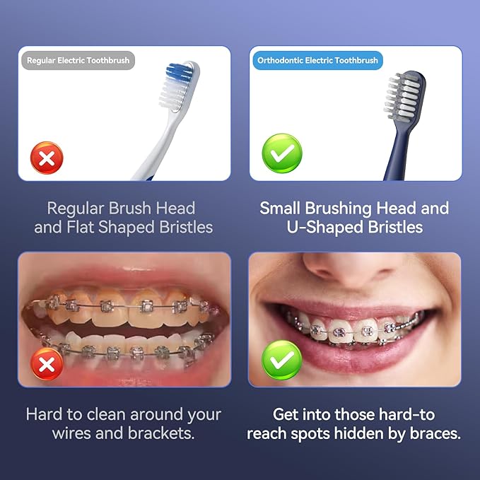 JTF Orthodontic Electric Toothbrush for Braces: 6 U-Shaped Soft Brush Heads, 5 Brushing Mode, 2Min Timer, IPX7 Waterproof, Deep Oral Clean, Rechargeable Sonic Toothbrushes for Tooth with Dental Device