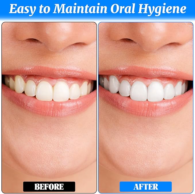 4 PCS Dental Tooth Stain Eraser Removers, Dental Plaque Tartar Eraser Polisher Professional Dental Picks Tooth Polisher and Plaque Remover for Teeth Whitening Polishing Adult Oral Care (4 Color)