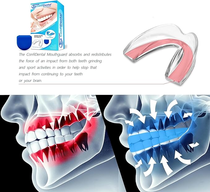 The ConfiDental - Pack of 4 Moldable Mouth Guard for Teeth Grinding Clenching Bruxism, Sport Athletic, Whitening Tray, Including 2 Regular and 2 Heavy Duty Guard (2 (LLL) Regular 2 (II) Heavy Duty)