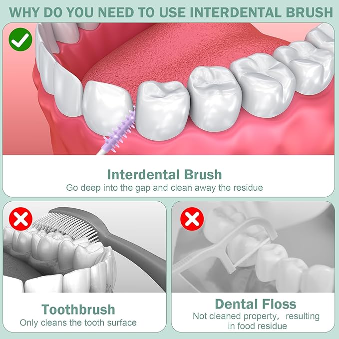 600 Pcs Soft Interdental Brushes Disposable Gum Picks Dental Floss with Case Picks Dental Braces Brush for Teeth Cleaning and Gum Health