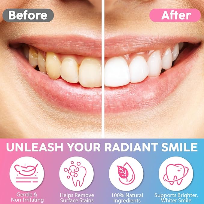 Niacinamide Whitening Toothpaste 200g - Niacinamides Toothpaste Stain Removal, Gentle on Sensitive Teeth & Gums, Fluoride-Free, Natural Enzymes, Dentist-Developed for Coffee & Tea Lovers