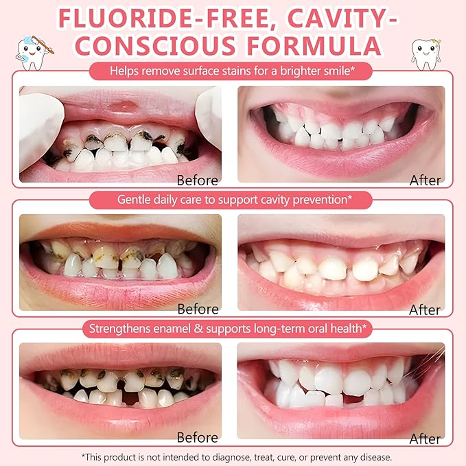 Kids Toothpaste Strawberry Flavor, Swallowable Toothpaste with xylitol and Vitamin E, Fights Plaque, Designed for Children, 2.1OZ