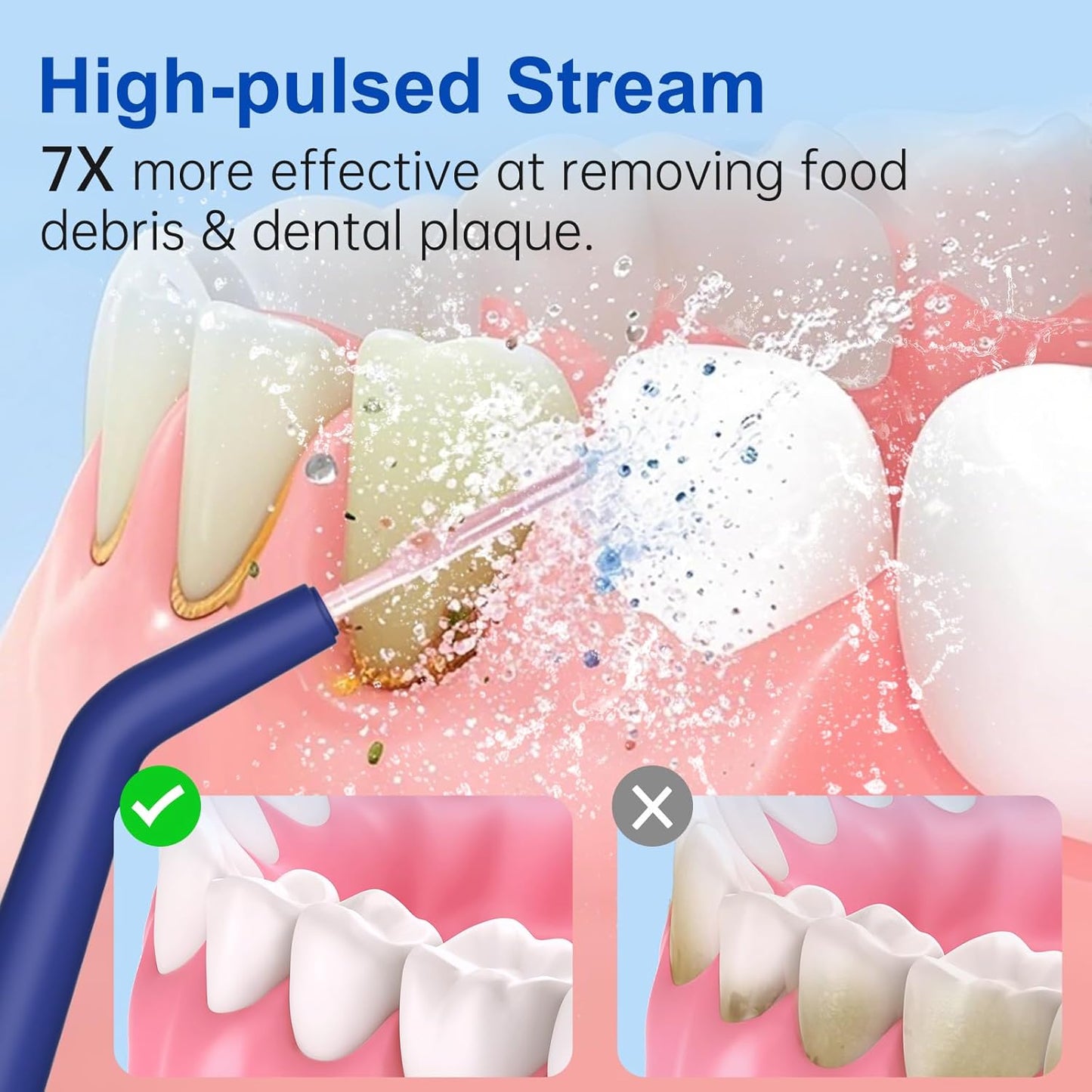 Water Dental Flosser Pick for Teeth: Cordless Rechargeable Oral Irrigator - 4 Modes IPX7 Waterproof 300ML Removable Tank Electric Dental Flossing Machine for Braces, Travel & Home Use (Dark Blue)