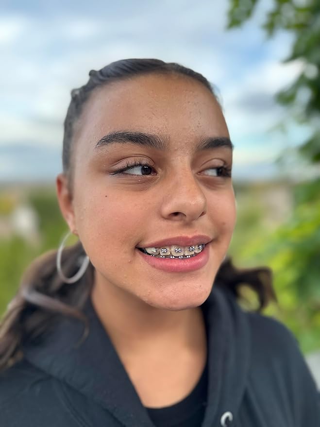 Orthodontic Wax – Original Honey, Natural Braces Protection, Long-Lasting Comfort, Pre-Cut Wax Pieces in Aluminum Travel Case(75 Buttons) - Original Honey