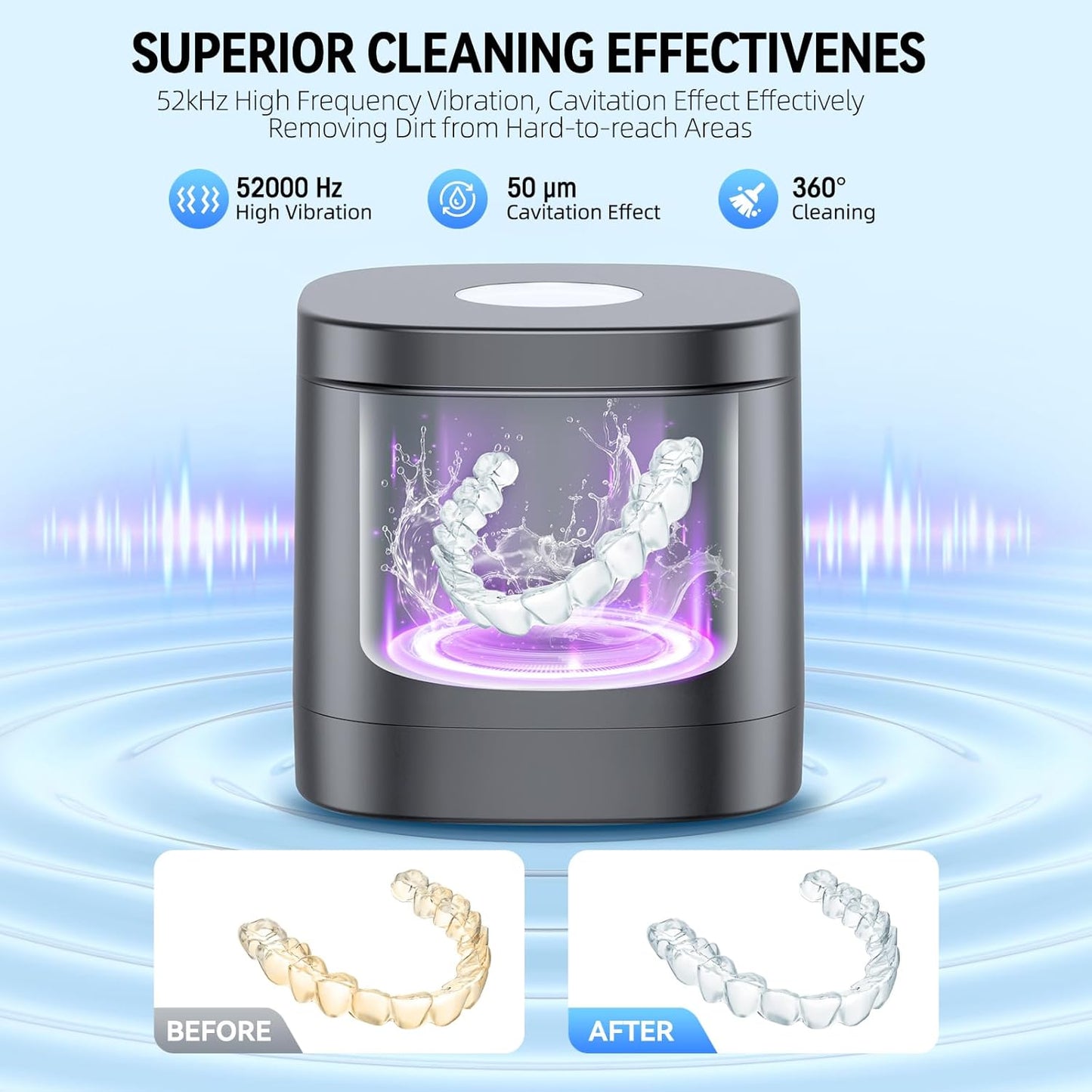 TEBAL Ultrasonic Retainer Cleaner Machine, 52kHz Ultrasonic Denture Cleaner for Night Guards, Braces, Toothbrush Heads, Jewelry and More, Ultrasonic Cleaner for Retainers with 250ML Capacity, Black