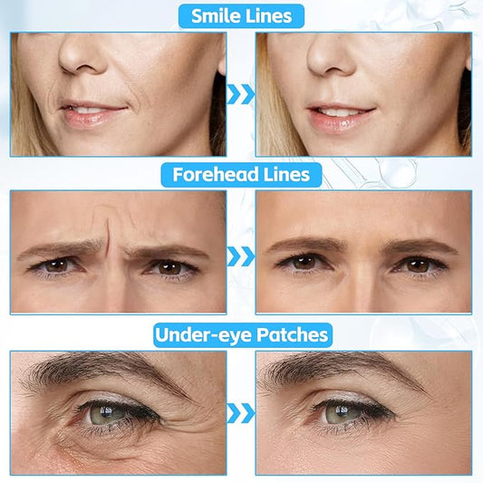 10 PCS Facial Wrinkle Patch, Forehead Moisturizing Patch for Smooth Smile Line, Frown Line & Crows Feet, Facial Pads for Under Eyes, Lips, Forehead