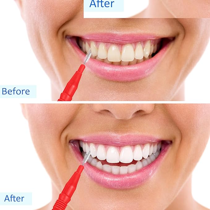 BBTO 100 Pcs Braces Dental Brush Flosser for Cleaner Interdental Brush Toothpick Tooth Flossing Head Oral Dental Toothpick Cleaners Cleaning Tool(Red)