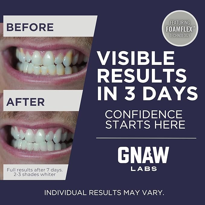 Teeth Whitening Strips for Men – Mint Fresh | 14 Treatments | Enamel Safe Hydrogen Peroxide Formula with Mint | FoamFlex™ Technology | No Sensitivity, Professional Whitening Kit.