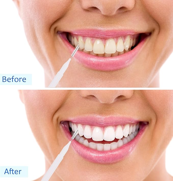 Patelai 100 Pieces Braces Brush for Cleaner Interdental Brush Toothpick Dental Tooth Flossing Head Oral Dental Hygiene Flosser Toothpick Cleaners Tooth Cleaning Tool(White, Black, Pink,Proper Size)