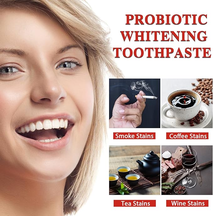 2PCS SP-8 Toothpaste, SP-8 Probiotic Whitening Toothpaste, for Fresh Breath, Protects Teeth & Oral Health, Rich Foam & Easy Rinse, Deep Cleaning Care