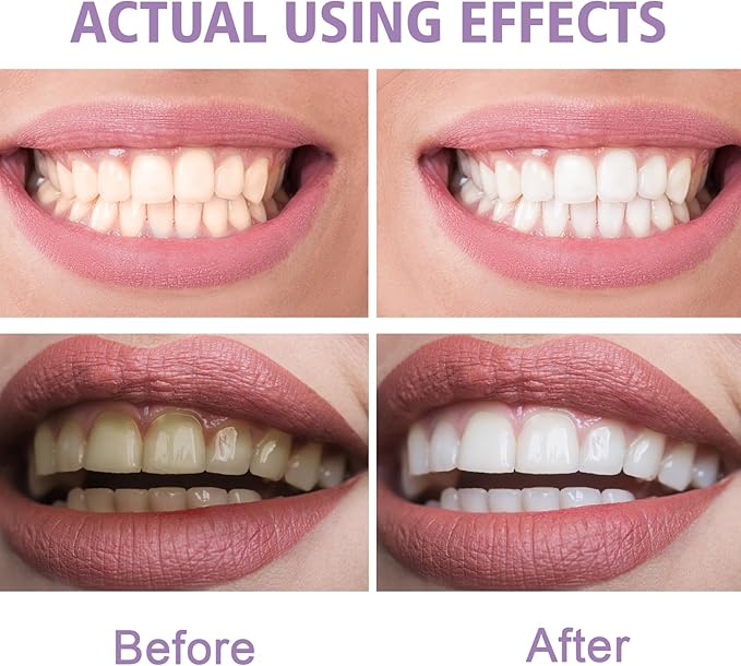 PEGO Adult Tooth Powder, Stain Remover for Teeth - Deep Cleaning Formula, Gentle & Non-Irritating, Effective Plaque Removal, Fresh Breath, Daily Oral Care for Adults (Baking Soda)