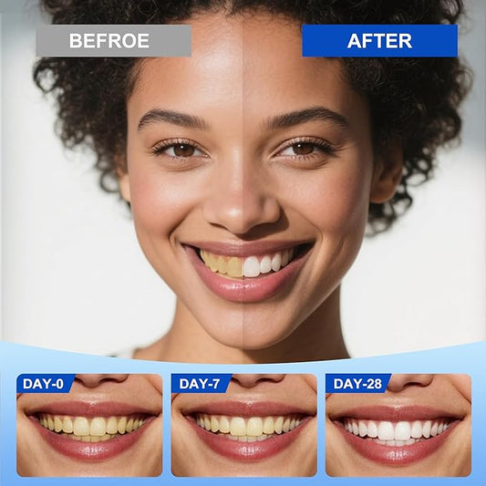 SP-6 Hydroxyapatite Toothpaste Set, 6 Probiotics for Whitening & Cooling Fresh Breath, 7- Pro Intense Whitening, Fluoride-Free, Safe for Enamel, Deep Brigthtening & Freshness (3 Tubes)