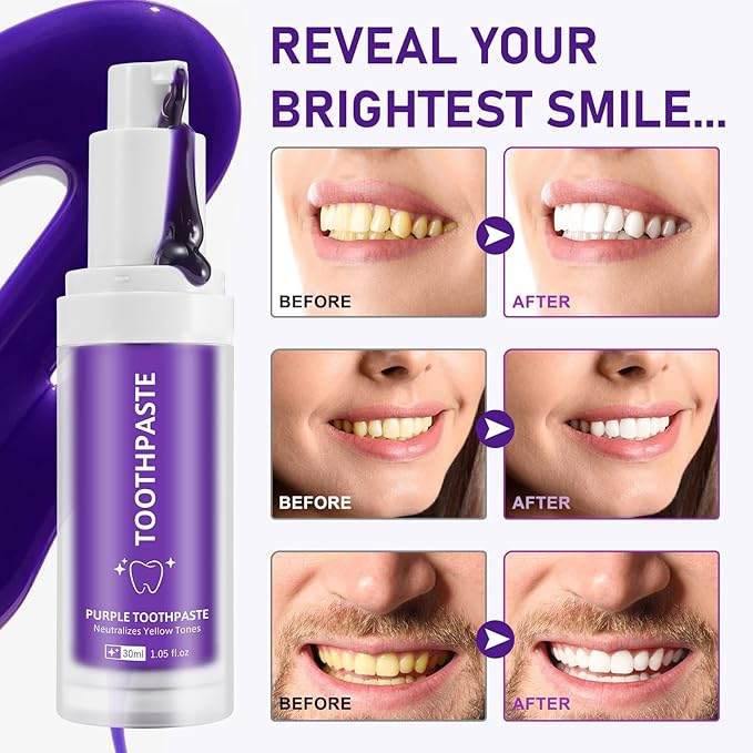 Purple Toothpaste, Teeth Whitening Colour Corrector Toothpaste for Teeth Whitening, Color Correcting Technology, Natural Removal Surface Stain