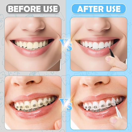 120Pcs Interdental Brushes, 360° Bendable Soft Bristles Braces Flossers Brush Dental Brushes Between Teeth Dental Floss Picks for Gum Braces Oral Teeth Cleaning Tool