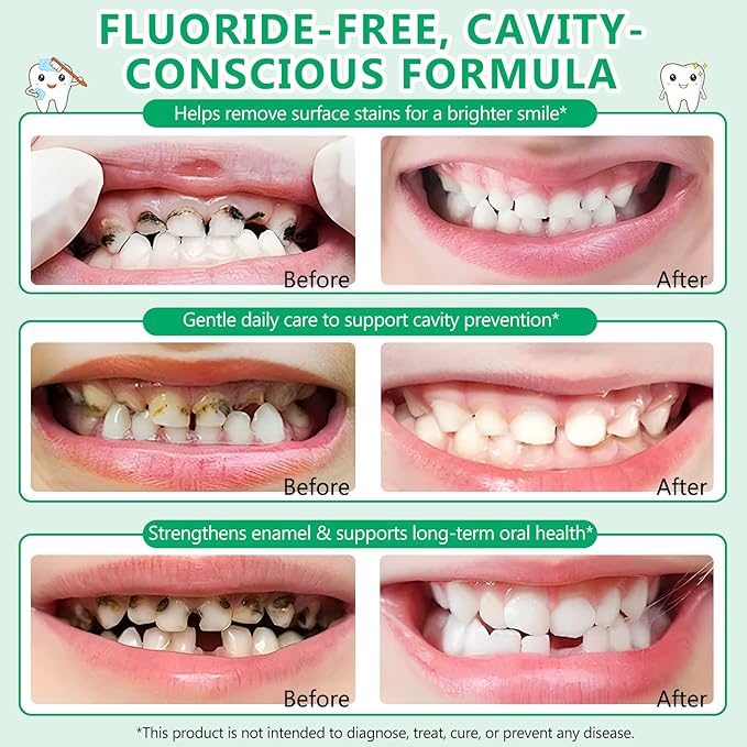 Kids Toothpaste Watermelon Flavor, Swallowable Toothpaste with xylitol and Vitamin E, Fights Plaque, Designed for Children, 2.1OZ