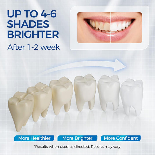 5 x Teeth Whitening Pen Gel (4+1 Desensitizing Gel), No Sensitivity Teeth Whitening Gel Kit, Effective Teeth Whitener, Travel-Friendly Tooth Whitening Pen, Carbamide Peroxide Tooth Bleaching