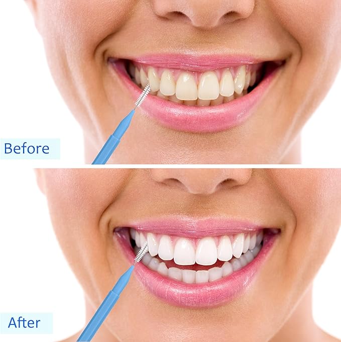 Patelai 100 Pieces Braces Brush for Cleaner Interdental Brush Toothpick Dental Tooth Flossing Head Oral Dental Hygiene Flosser Toothpick Cleaners Tooth Cleaning Tool (Blue, Green,Elegant Size)