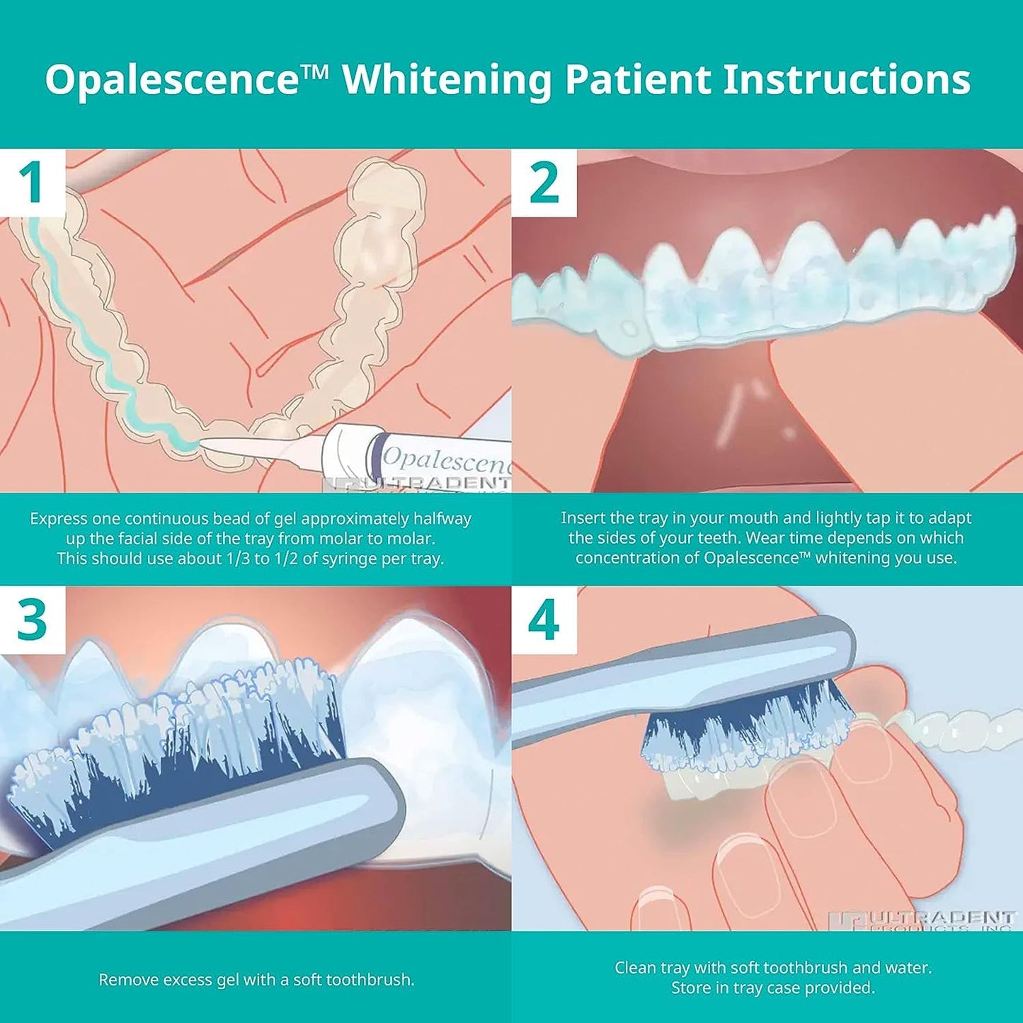 Opalescence 35% Gel Syringes Teeth Whitening - Refill Kit (12 Syringes), Made by Ultradent, Carbamide Peroxide in Mint Flavor. Tooth Whitening 5197-12