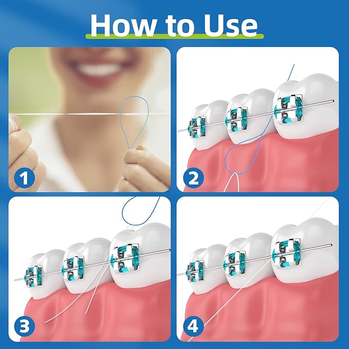RioRand Floss Threaders,Essential Tool for Maintaining Oral Health with Braces, Bridges, and Implants 200 Count (Pack of 4)