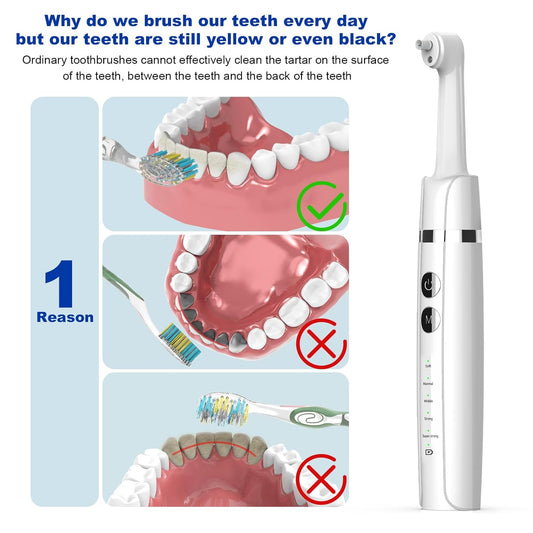 Tooth Polisher,Teeth Polishing Kit for Daily Cleaning,Polishing Then Whitening of Tooth (Professional Toothpaste Include),USB Rechargeable Dental Polisher with LED Light,6 Heads,5 Speed Modes