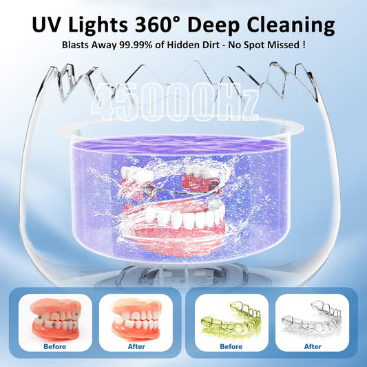 Ultrasonic Retainer Cleaner Machine for Denture, Dental Cleaning Pod with Digital Timer, 45kHz/180ML Waterproof Ultrasonic Denture Cleaners for Aligner, Mouth Guard, Braces, Ring Jewelry Cleaner