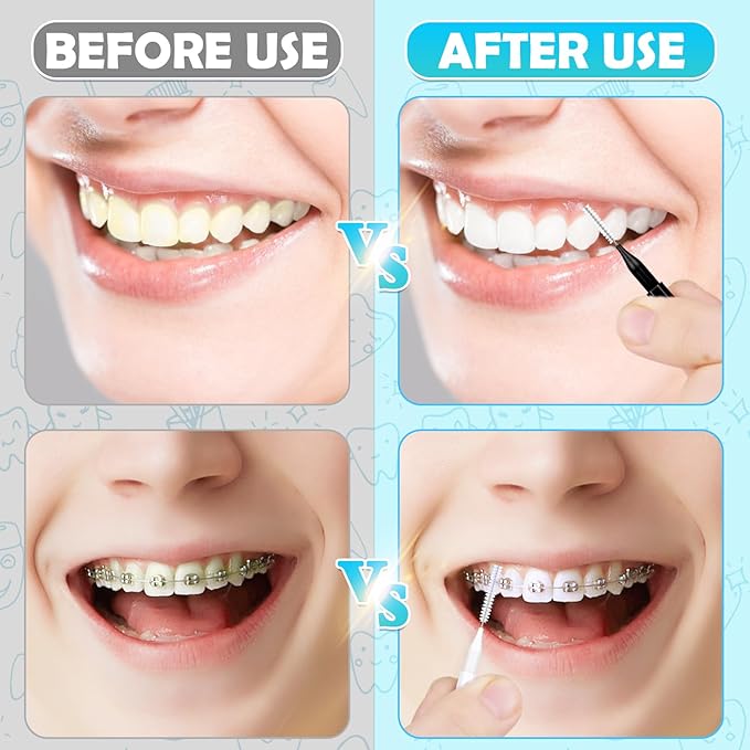 120Pcs Interdental Brush, Braces Brush Toothpicks with Soft Bristles 360° Bendable Floss Heads Dental Brushes Between Teeth Gum Braces Cleaning Kit Oral Tooth Cleaning Tool （Black, White）