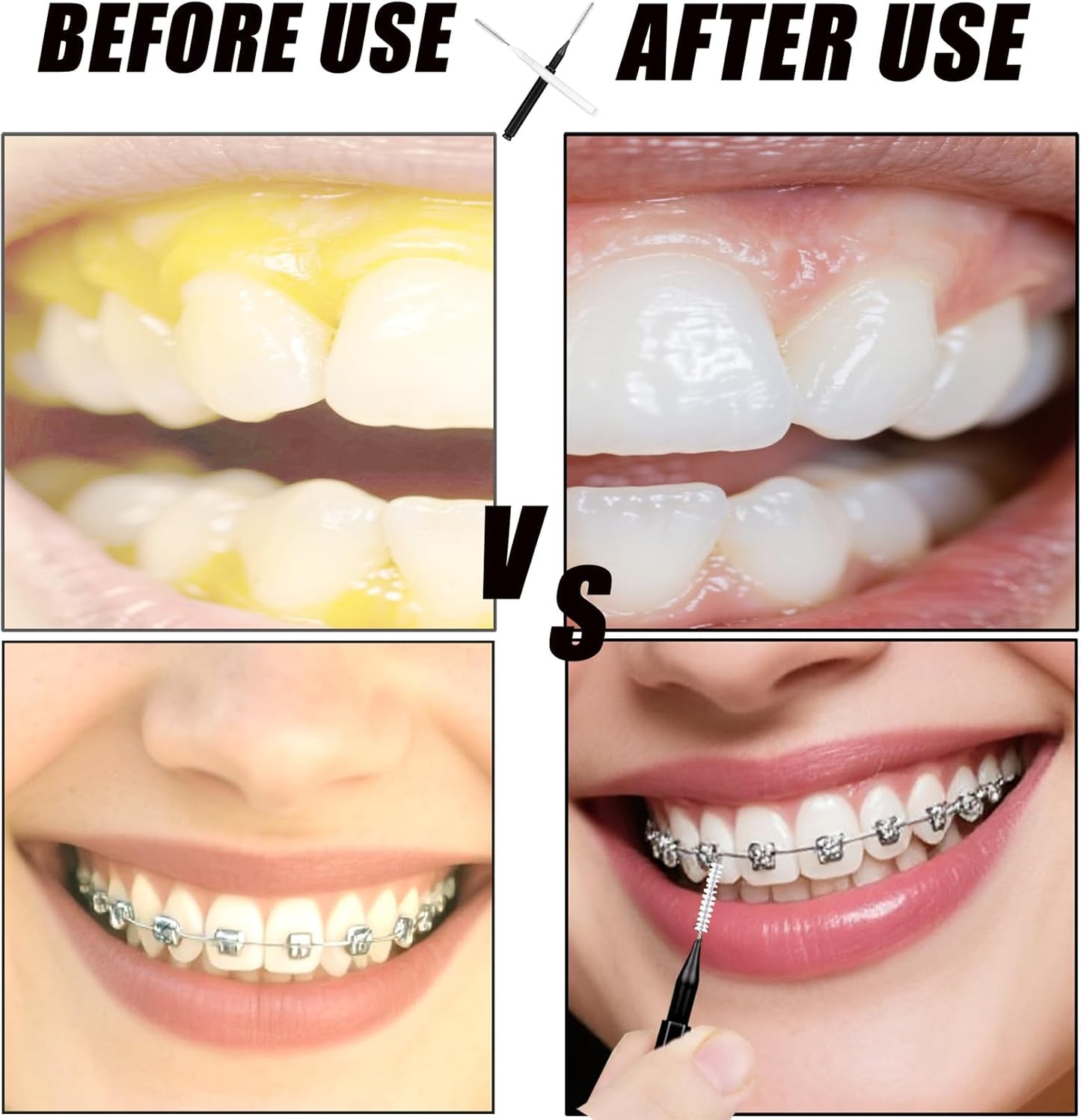 130-Count Interdental Brushes Set - Black & White Orthodontic Cleaning Kit with Spiral Brush Heads, Braces-Friendly Flossers & Toothpicks for Efficient Teeth & Braces Care