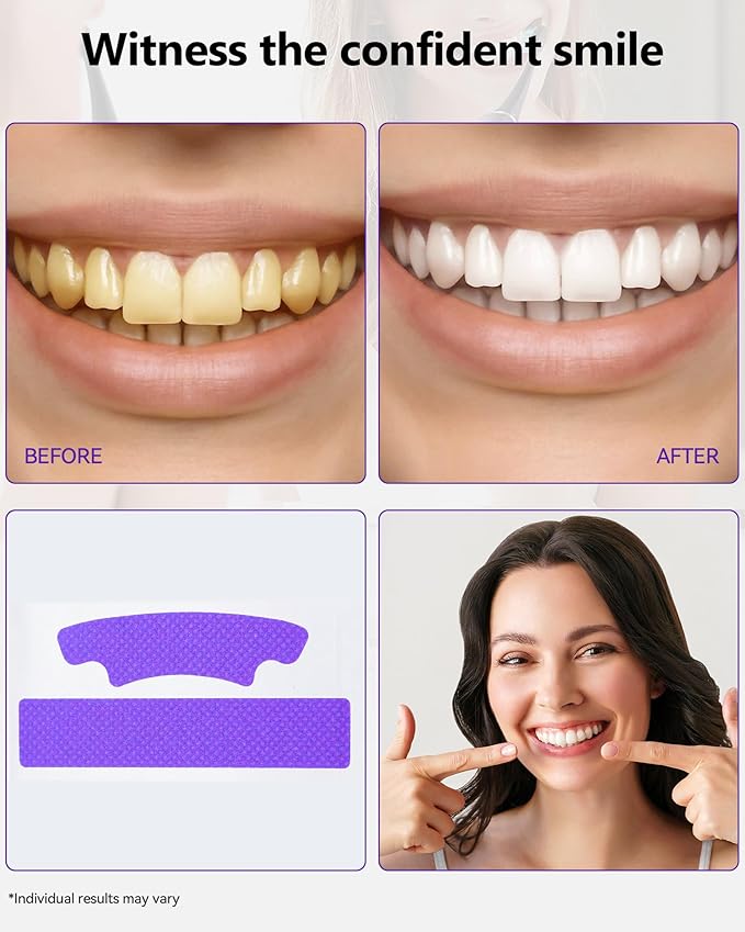 Teeth Whitening Strips 7 Treatments, Enamel Safe for Sensitive Tooth, Whitens Teeth, Purple Whitening Strips, Removes Yellow Stains & Bad Breath - Effective Color Correction for a Brighter Smile