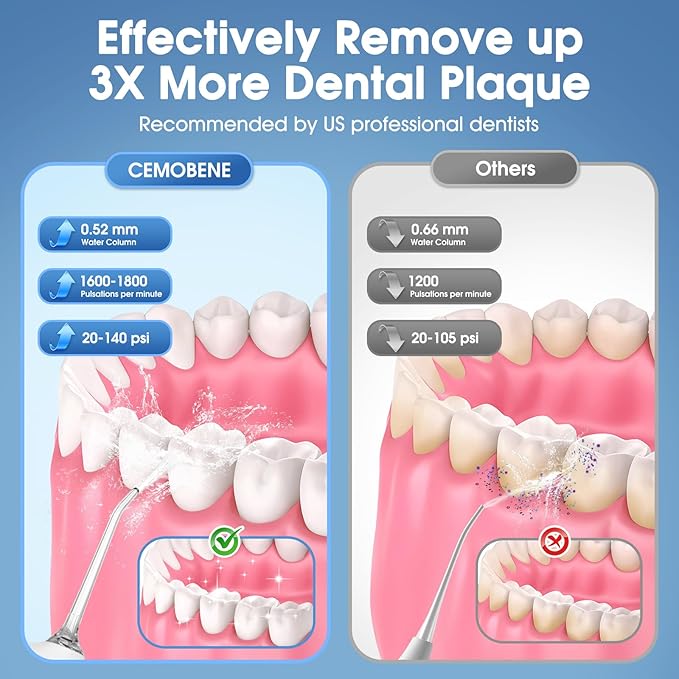 Water Flosser, Rechargeable 300ML IPX7 Waterproof Cordless Portable Oral Irrigator with 4 Modes & 6 Replaceable Jet Tips-Professional Flossing Cleaner for Daily Home Use,Travel,Gums,Braces Care(White)