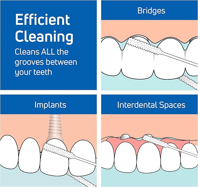 TePe Bridge and Implant Floss for Dental Implants, Bridges, and Braces, Dental Flossers, 30 Pieces (Pack of 2)