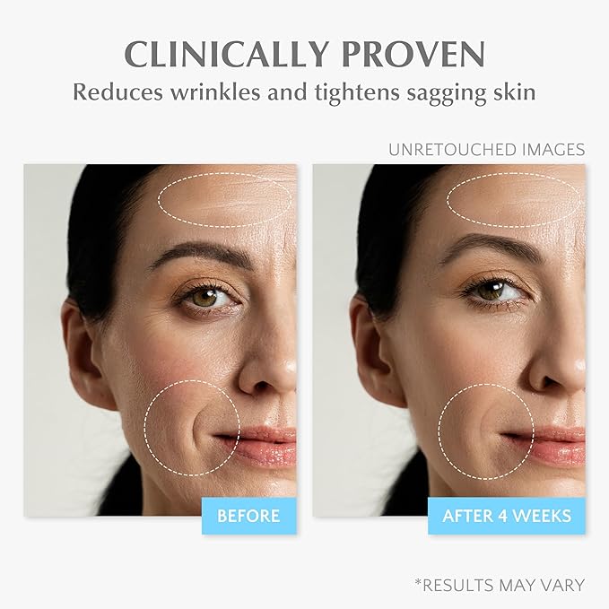 EnaSkin Retinol Collagen Face Cream: Wrinkle Cream for Women, Neck & Décolleté Anti Aging Moisturizer with 7% Hyaluronic Acid Serum - Day/Night Skin Firming & Tightening, 1.7 Oz