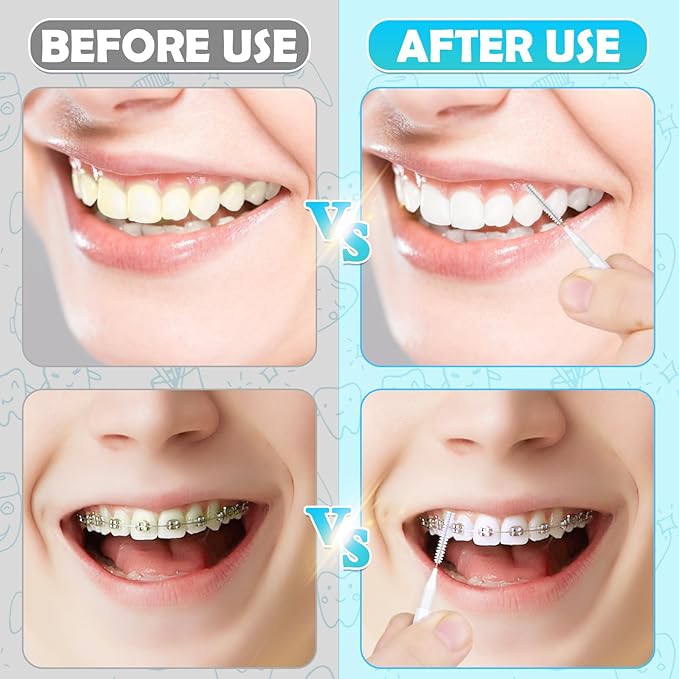120 Pieces Interdental Brushes, Braces Brush Cleaner Orthodontic Flossers Toothpicks Floss Picks for Braces Kit for Teeth Cleaning Tools Spiral Dental Brush Head for Efficient Oral Care White