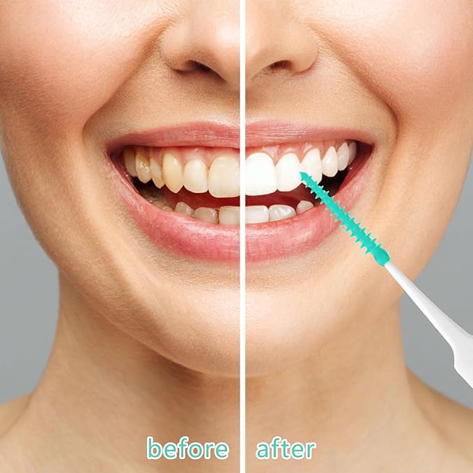 220 Pieces Interdental Brushes, Silicone Dental Floss Picks with Case Dental Brushes Dental Picks Green Tooth Floss Picks for Teeth Cleaning(Green)