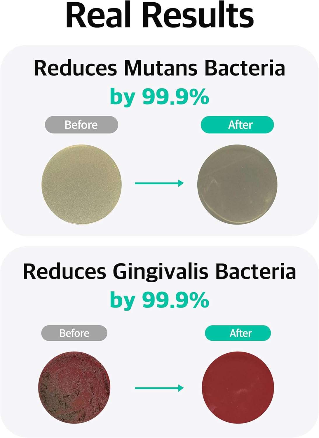 Live Orals PureBreath Toothpaste 80g (Pack of 5)- Fluoride-Free, Odor Neutralizing, Enamel Strengthening, Gentle Cleaning, Mint Fresh, Naturally Derived Ingredients, Sensitive Teeth Friendly